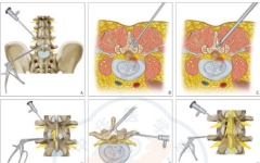 UBE����������˫ͨ�������ھ�����׵��׾������ĶԱ�