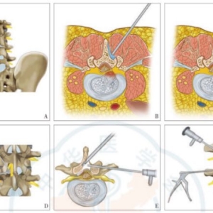 UBE����������˫ͨ�������ھ�����׵��׾������ĶԱ�